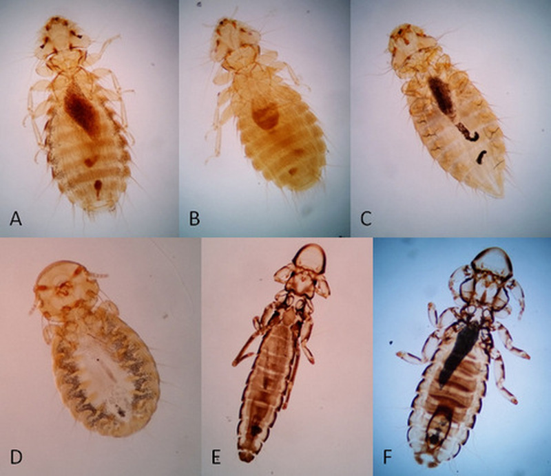 Can Chicken Lice Transfer To Humans?  