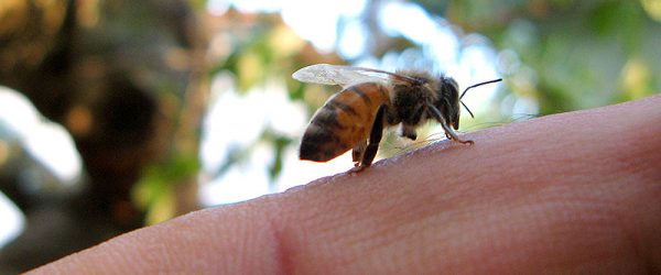 Yow! What to Do After a Sting by a Bee or Wasp